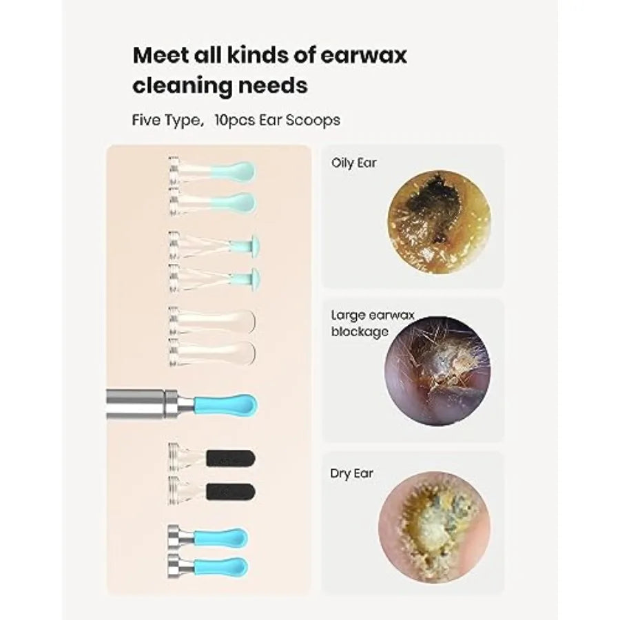 BEBIRD R1 Ear Wax Removal Tool With 1080P Camera Earscope