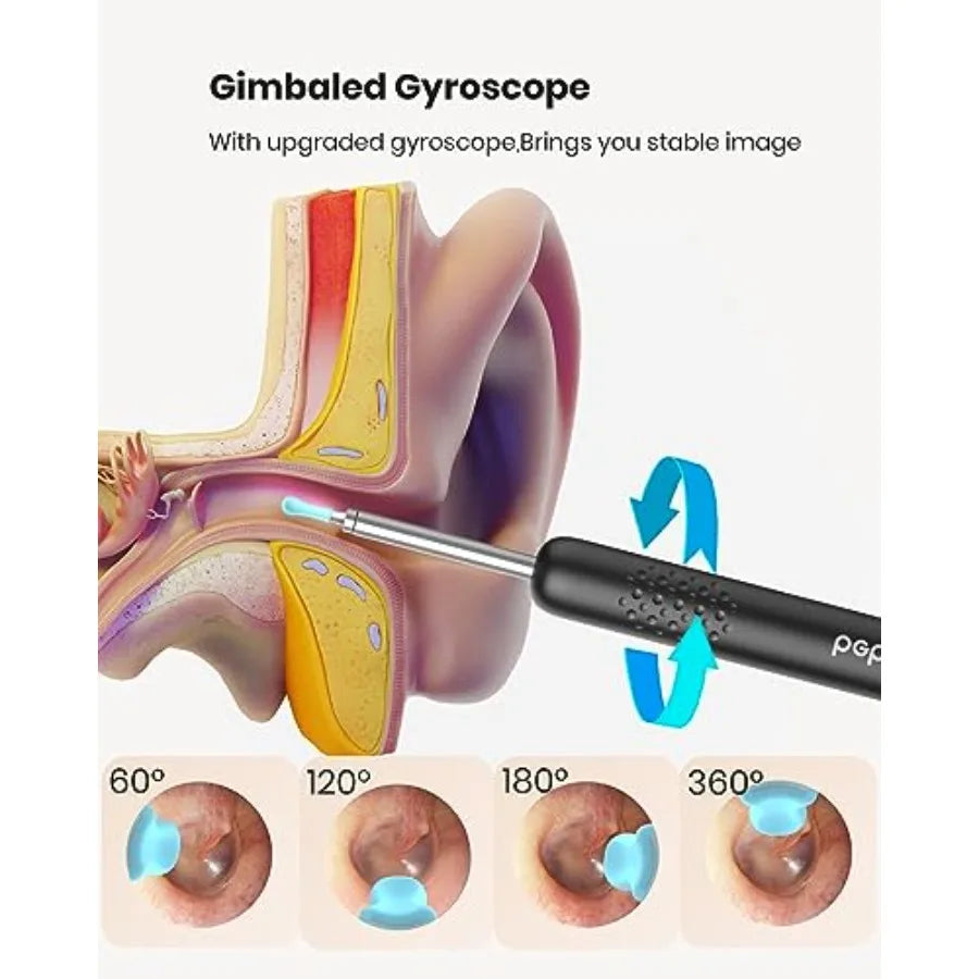 BEBIRD R1 Ear Wax Removal Tool With 1080P Camera Earscope