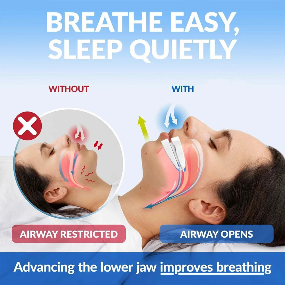 Night Sleep Adjustable Anti Snore Mouth Guard For Bruxism And Snoring Reduction